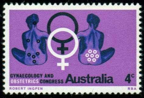 AUSTRÁLIE. gynekologický a porodnický kongres. symbolické znázornění. ženy jsou ale cudně otočeny